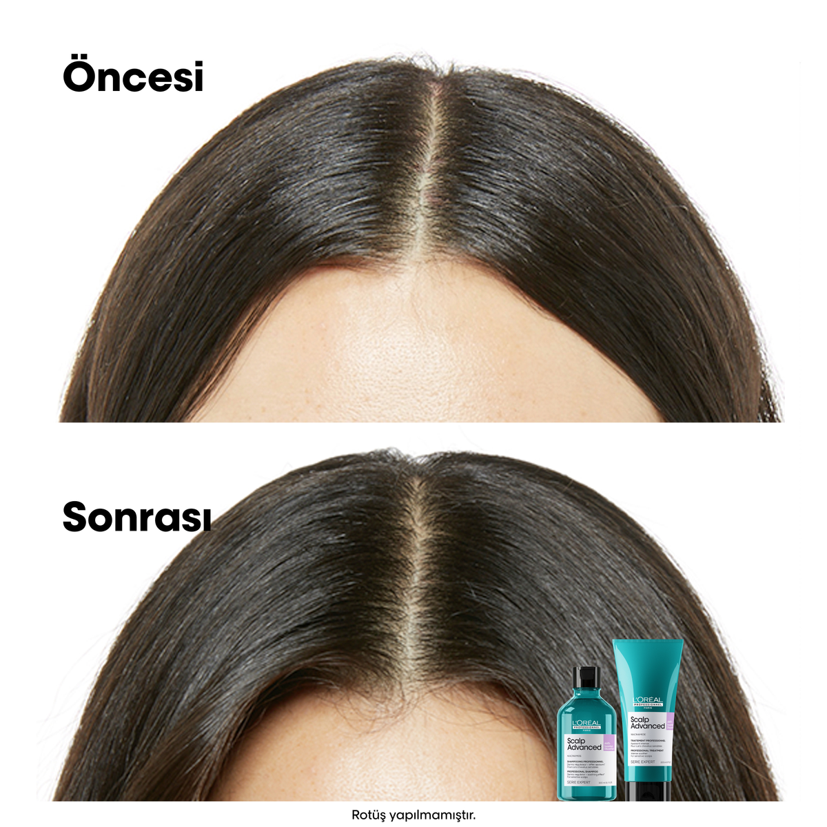 Loreal Professionnel Paris Serie Expert Scalp Advanced Hassas Saç Derisi için Profesyonel Şampuan 500 ml - Görsel 6