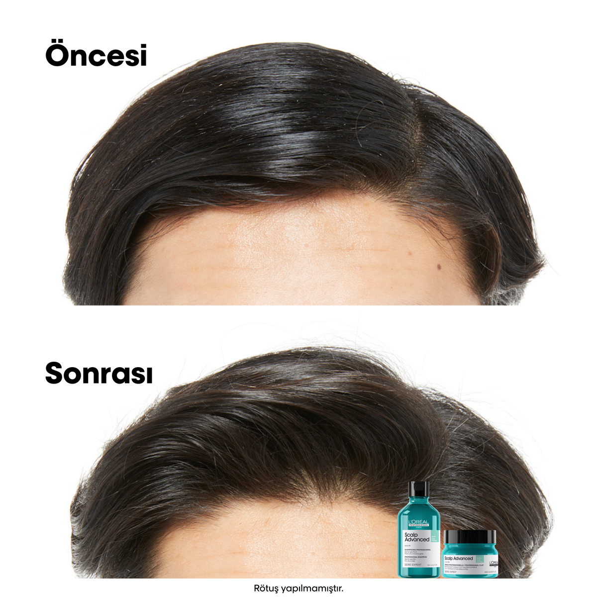 Loreal Professionnel Paris Serie Expert Scalp Advanced Yağlanma Karşıtı Profesyonel Şampuan 500 ml - Görsel 3