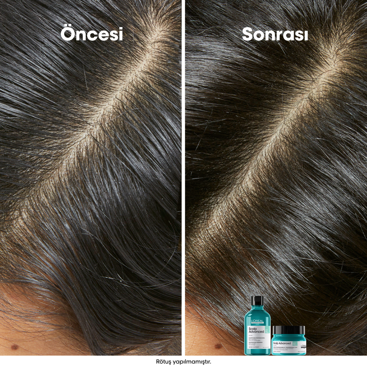Loreal Professionnel Paris Serie Expert Scalp Advanced Yağlanma Karşıtı Profesyonel Şampuan 500 ml - Görsel 6